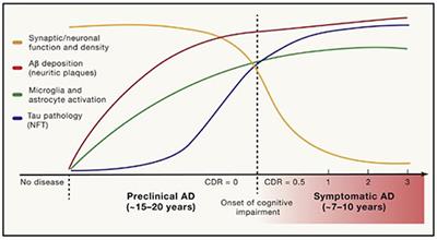 A how-to guide for a precision medicine approach to the diagnosis and treatment of Alzheimer's disease